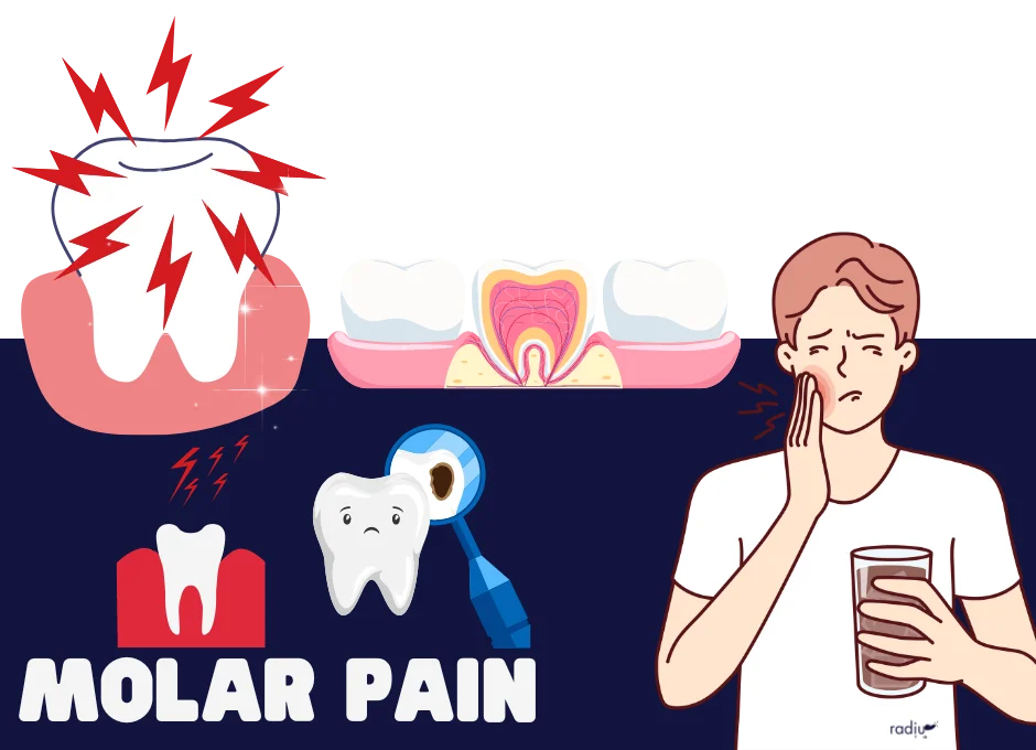 Best Pain Relief After Molar Extraction