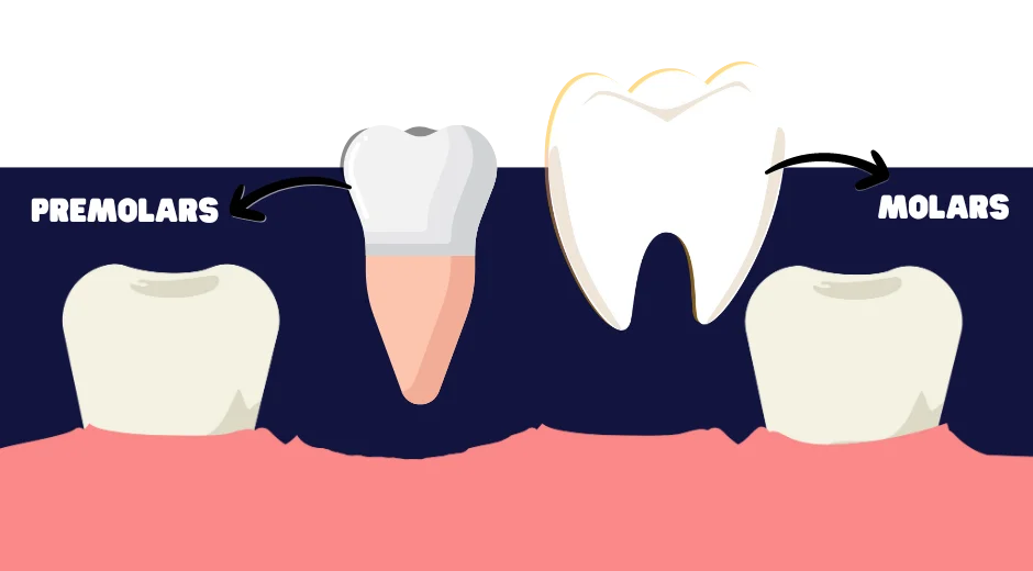 From Molars to Premolars Building