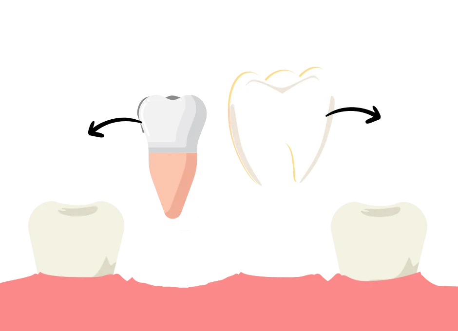 Molars to Premolars Building