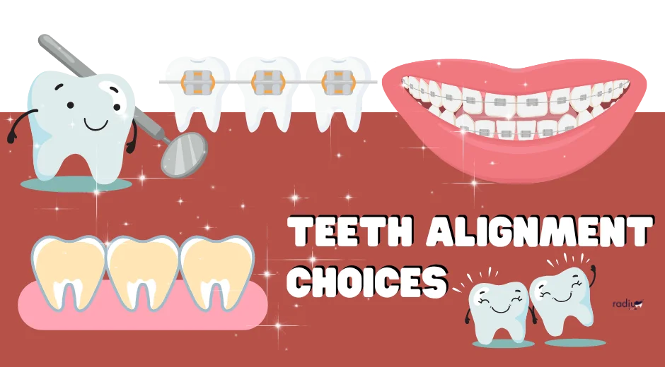 Teeth Alignment Choices for a Confident Smile