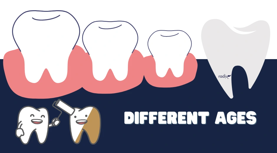 Canines Care for Different Ages_ tooth