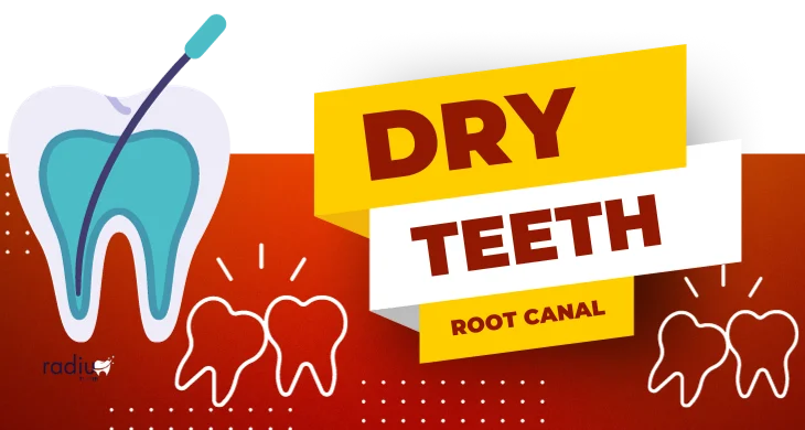 Dry Teeth and Root Cana