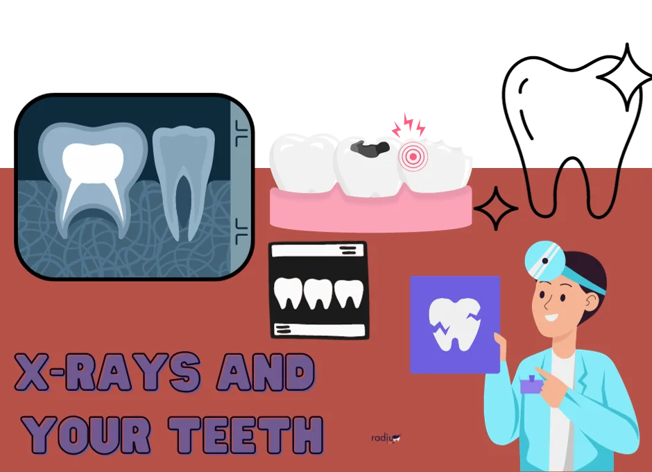 X-Rays and Your Teeth