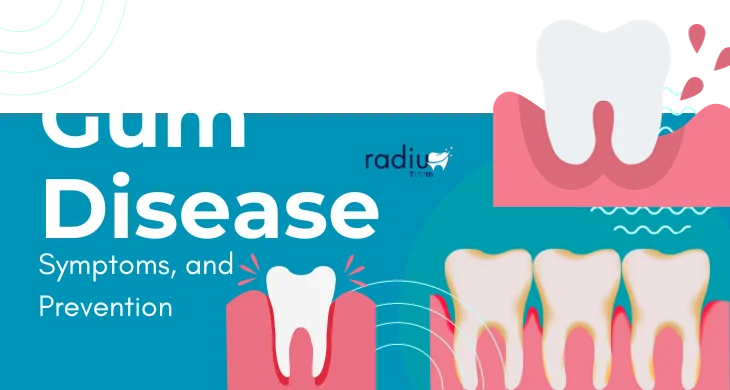 Gum Disease