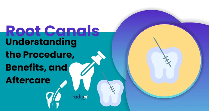 Root Canals