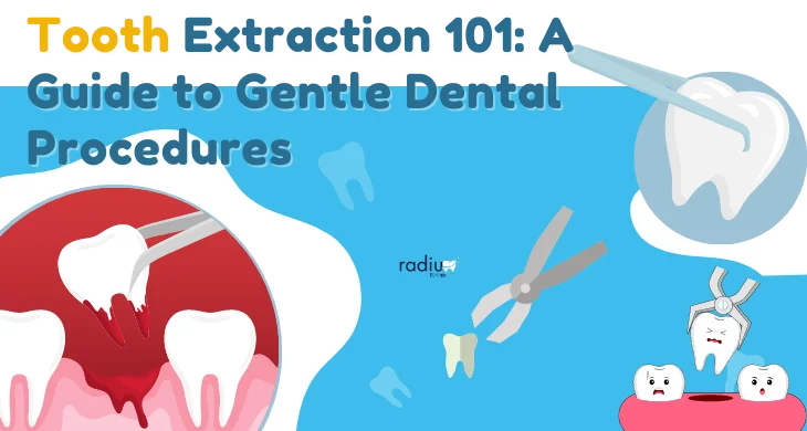 Tooth Extraction 101