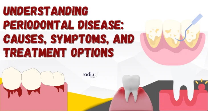 Understanding Periodontal Disease