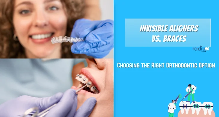 Invisible Aligners vs. Braces: Choosing the Right Orthodontic Option